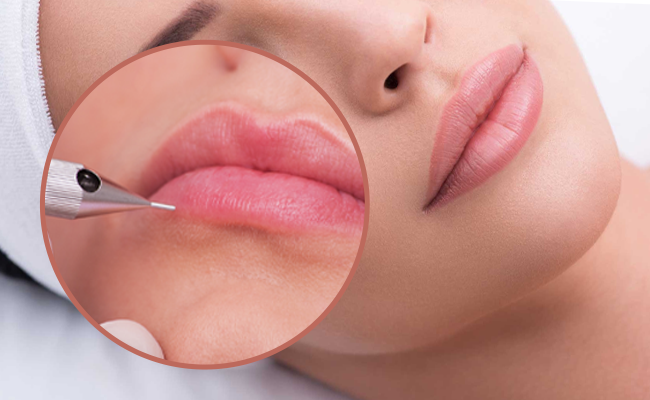 Micropigmentation des lèvres